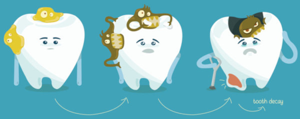 cauzele pierderii dintilor - Dr. Marana